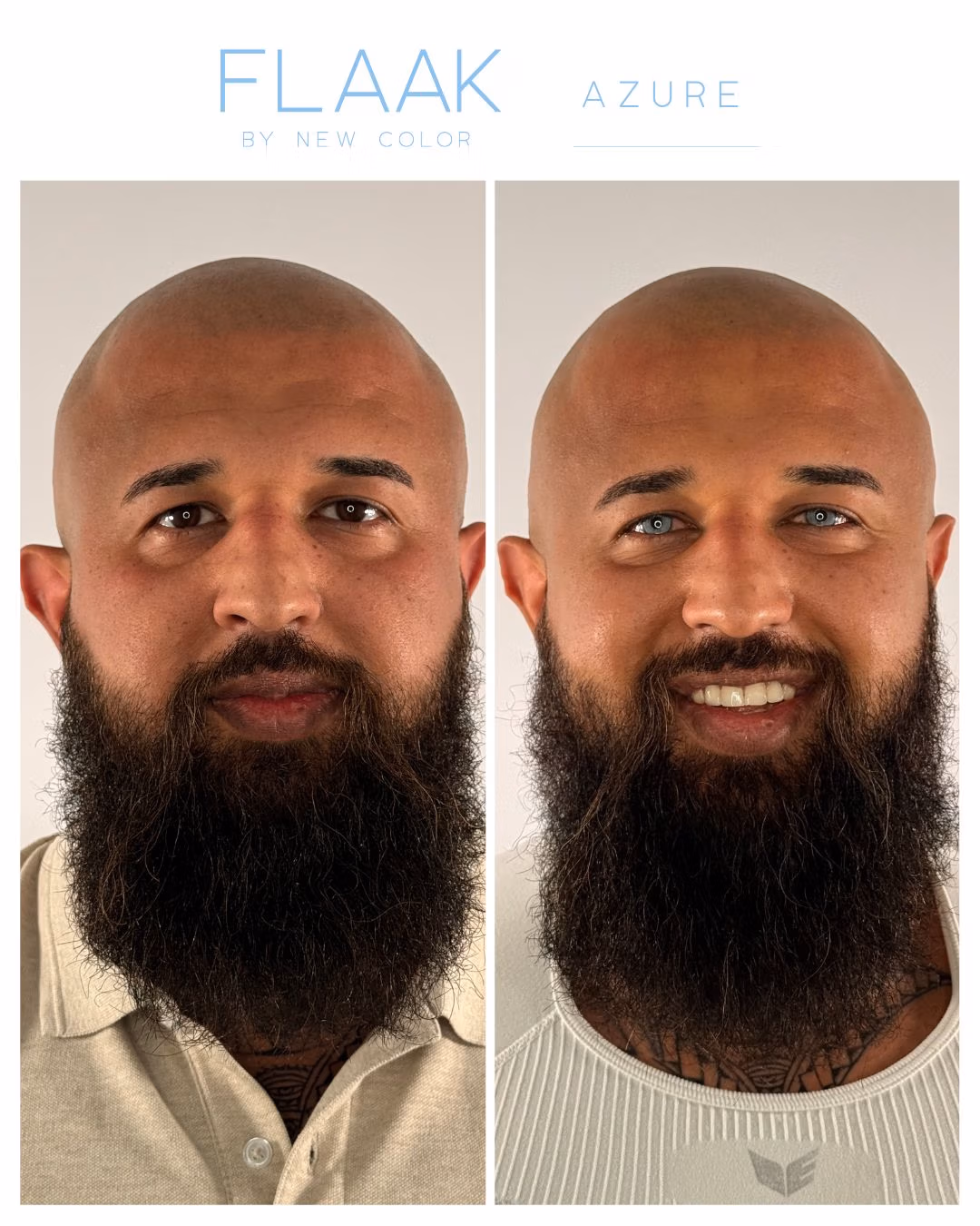 FLAAK Azure antes después